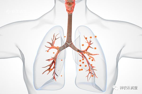 1708419674887365.png 640.png